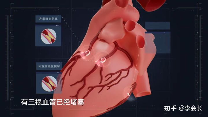 重疾險