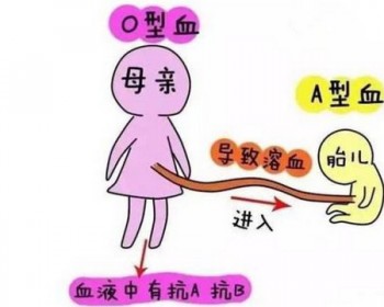 做過(guò)人流影響買(mǎi)重疾險(xiǎn)嗎，重疾新規(guī)修訂的影響有哪些？