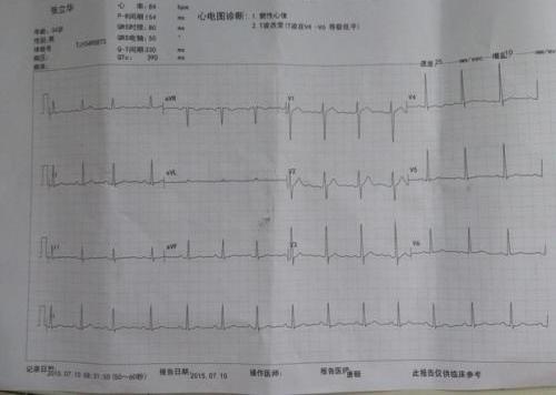 竇性心律t波改變買重疾
