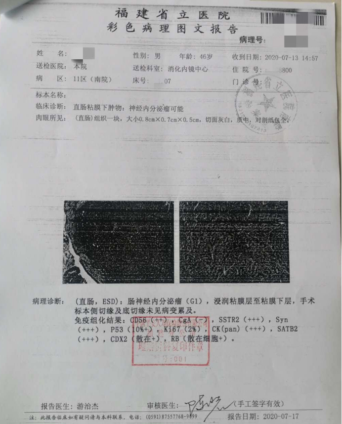 拒賠