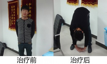 強(qiáng)直性脊柱炎可以買(mǎi)重疾險(xiǎn)嗎
