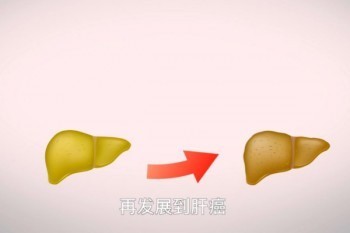 肝癌能買什么保險？最新投保指南請收好