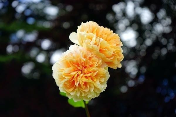 百萬醫(yī)療保險檢查費報銷嗎