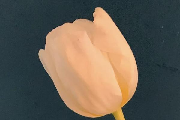 其他醫(yī)療保險(xiǎn)指什么？商業(yè)醫(yī)療保險(xiǎn)怎么買？