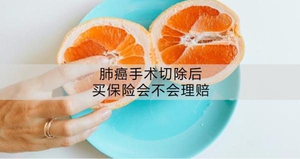 肺癌手術切除后買保險會不會理賠？保險理賠一般有哪些要注意的??？